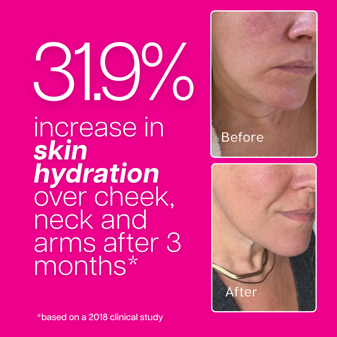 Ventamin Collagen Party: Doctor-Formulated Drink Mix for Firmer, Tighter, Younger Skin