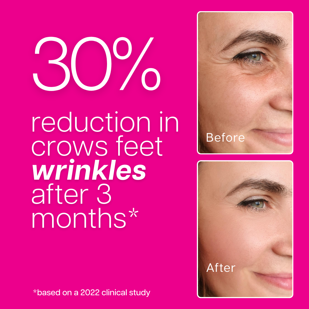 Ventamin Collagen Party: Doctor-Formulated Drink Mix for Firmer, Tighter, Younger Skin