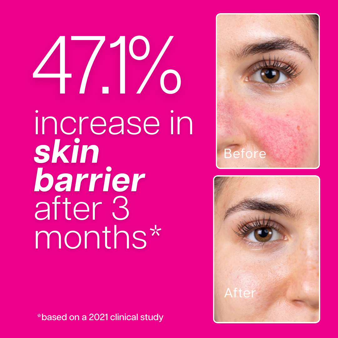 Ventamin Collagen Party: Doctor-Formulated Drink Mix for Firmer, Tighter, Younger Skin