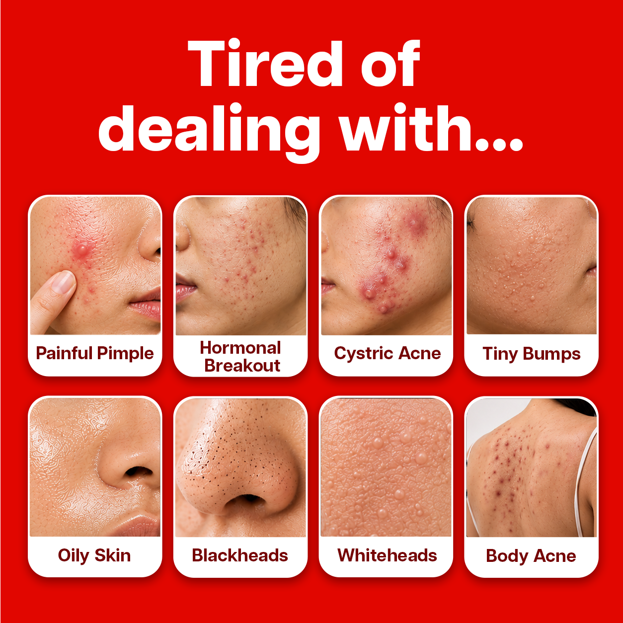Ventamin Clear It+: Doctor-Formulated Drink Mix for Acne & Breakout Control