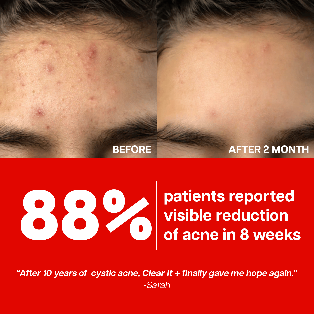 Ventamin Clear It+: Doctor-Formulated Drink Mix for Acne & Breakout Control