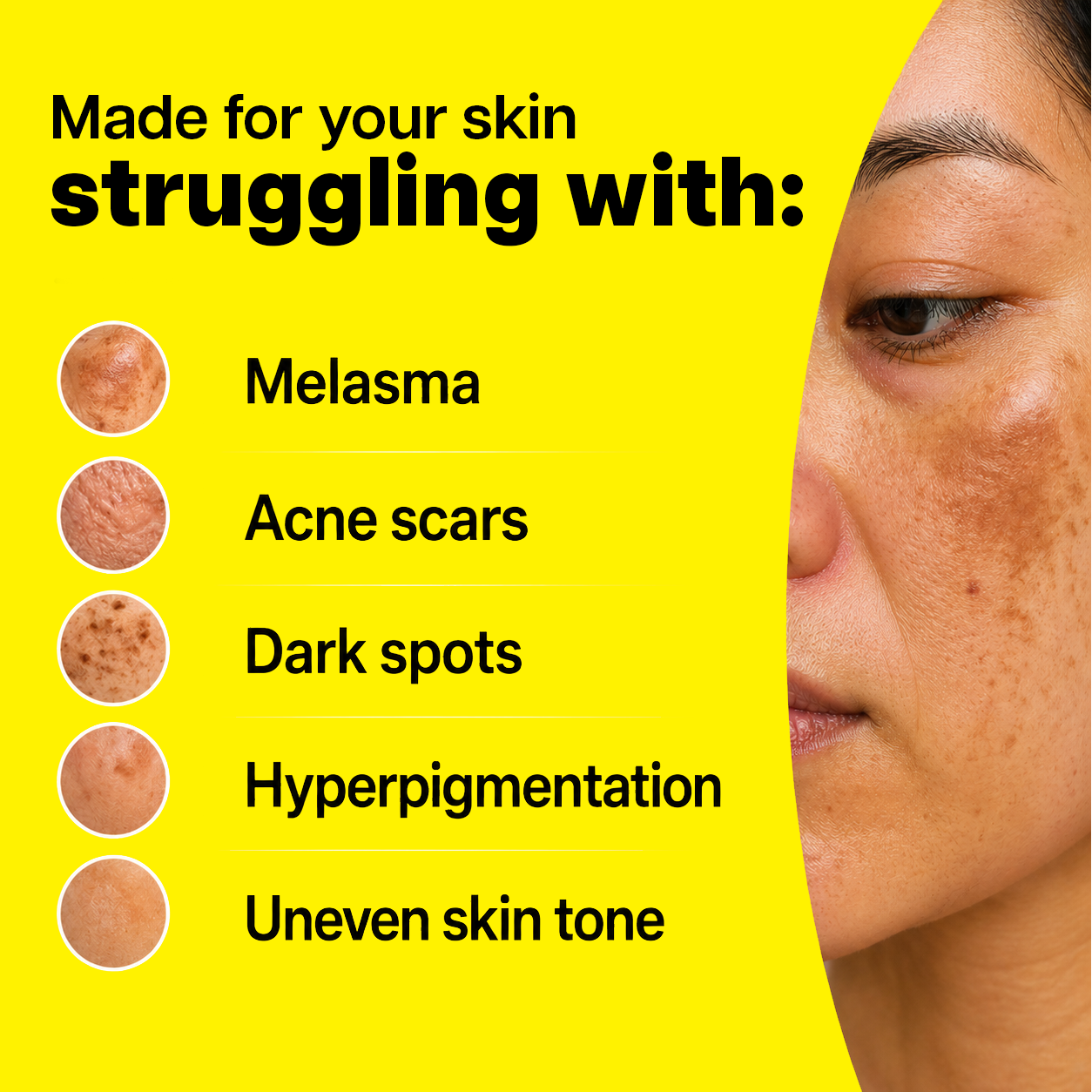 Ventamin Light Up: Doctor-Formulated Brightening Formula for Melasma, Acne scars & Hyperpigmentation