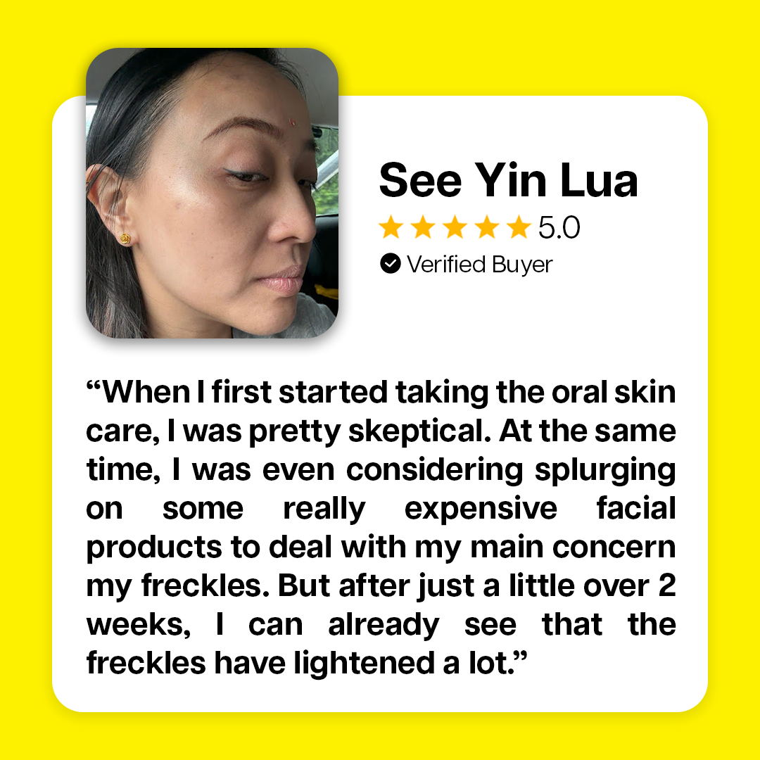 Ventamin Light Up: Doctor-Formulated Brightening Formula for Melasma, Acne scars & Hyperpigmentation