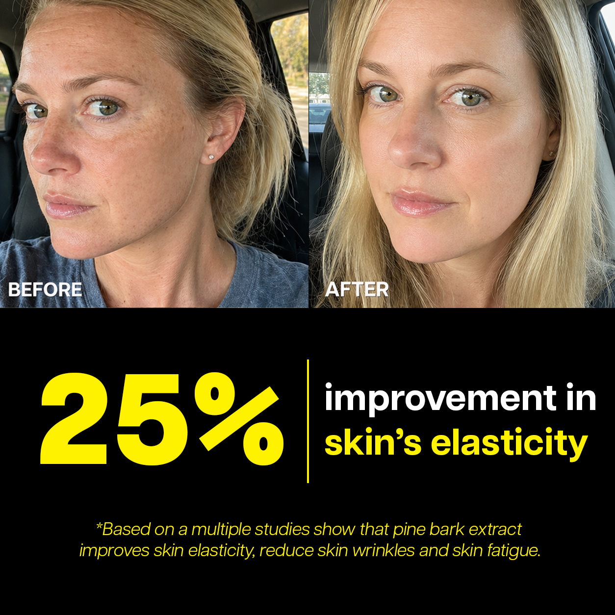 Ventamin Light Up: Doctor-Formulated Brightening Formula for Melasma, Acne scars & Hyperpigmentation