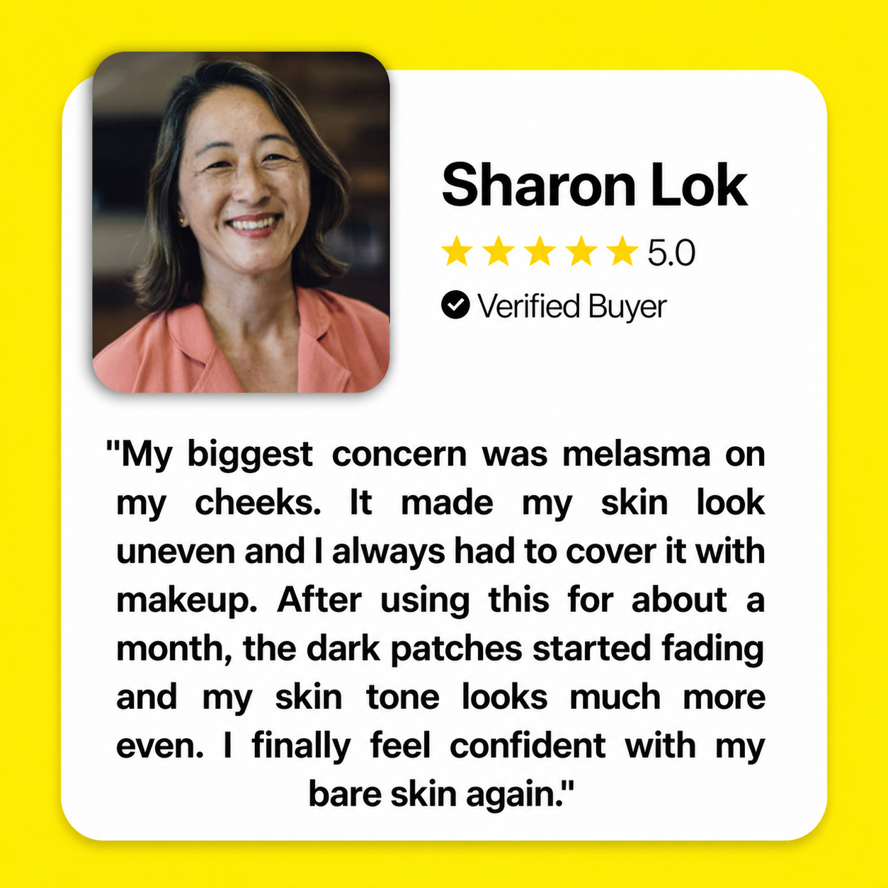 Ventamin Light Up: Doctor-Formulated Brightening Formula for Melasma, Acne scars & Hyperpigmentation