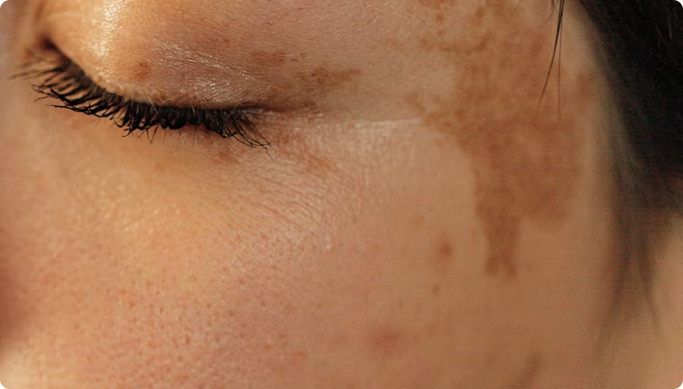 Skincare Ads Call It 